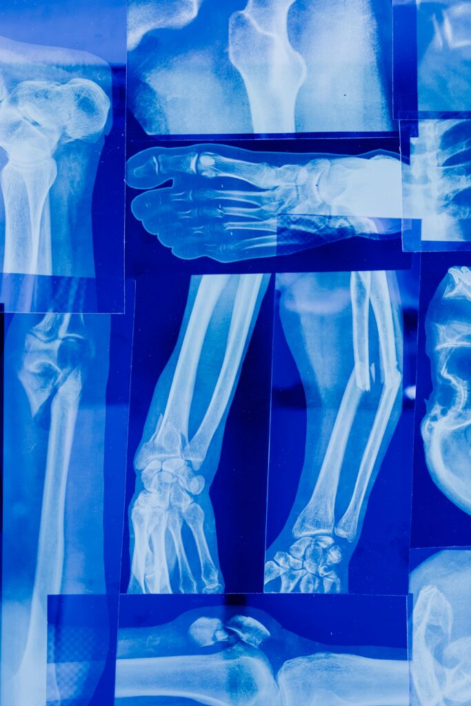 Detailed collage of human bone x-rays illustrating various skeletal parts in blue tonality.